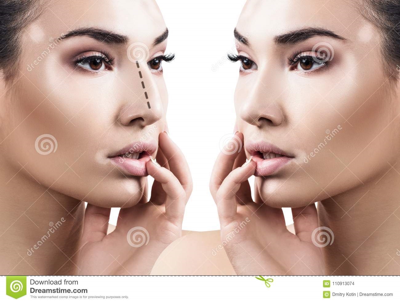 female-nose-cosmetic-surgery-portrait-female-nose-cosmetic-surgery-rhinoplasty-concept-110913074.jpg